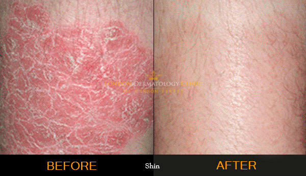 Organic Blackseed Hydrating Cream - Ancient Herbal Care