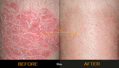 Organic Blackseed Hydrating Cream - Ancient Herbal Care