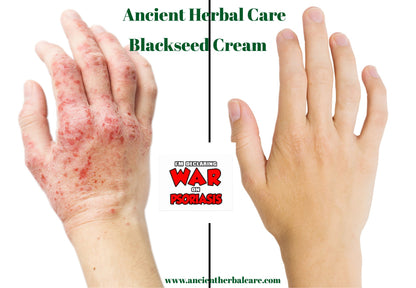 Blackseed Organic Body Lotion - Ancient Herbal Care